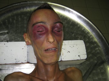 Stefano Cucchi 